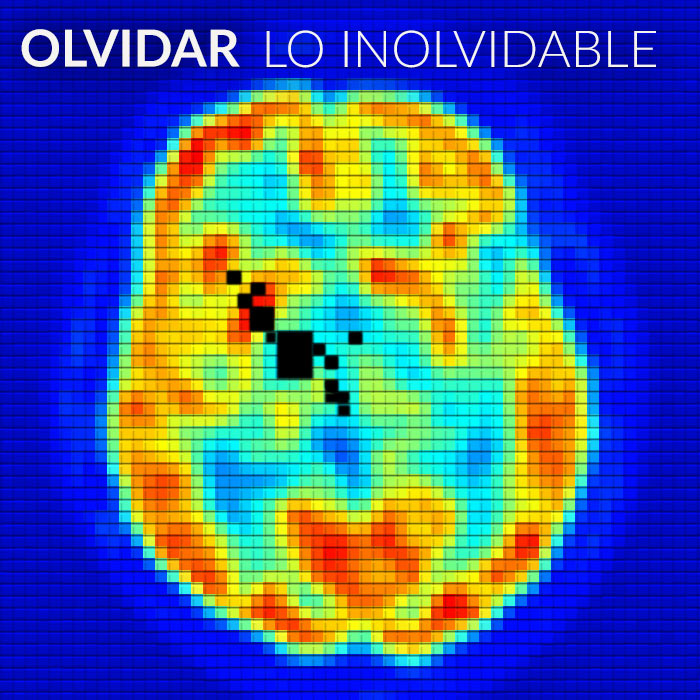 alzheimer.jpg